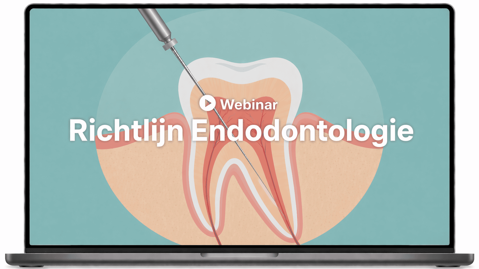 Praktische vertaalslag van de Richtlijn Endodontologie